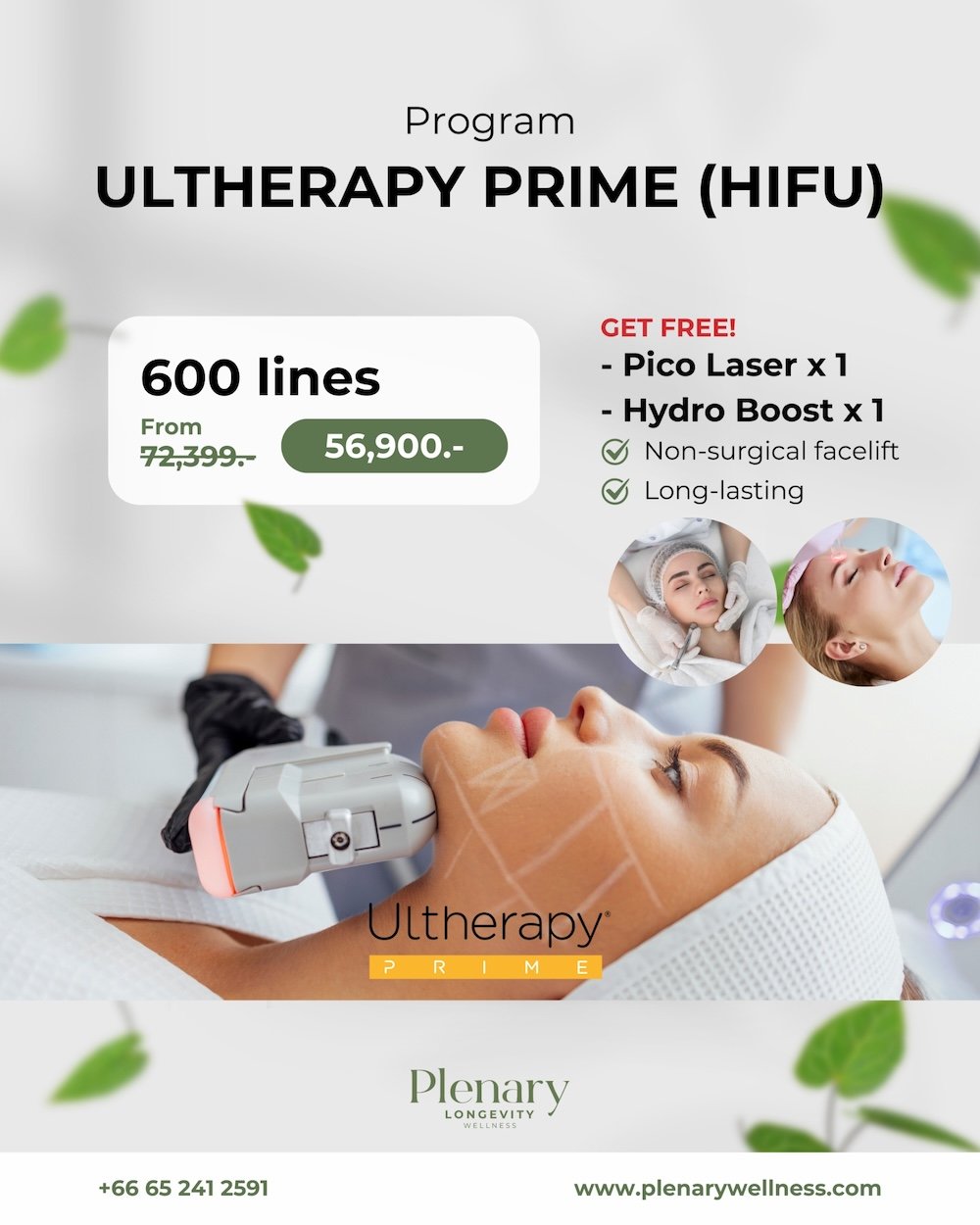 Ultherapy Prime (Hifu)